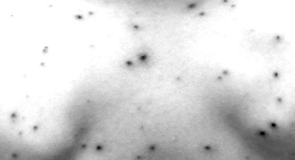 Exhorta SSO a vacunarse para prevenir el sarampión