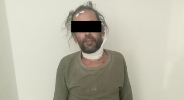 Fiscalía de Oaxaca obtiene Prisión Preventiva contra imputado por Maltrato Animal en San Francisco Lachigoló