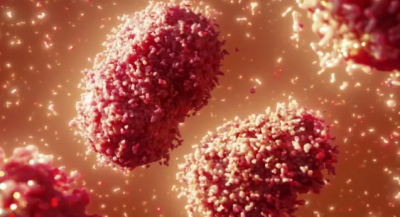 Servicio de Salud en Oaxaca envía muestra de caso probable de Viruela Símica (Mpox) al Indre